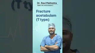 Dr. Ravi Mehrotra explains the different types of acetabular fractures in this video.
