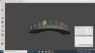 Meshmixer orthodontic aligners 3D CAD part 1