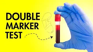 Double Marker Test in Pregnancy - What is it? How it's Done?