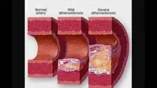 Cymatic Therapy With Cyma Technologies AMI 750