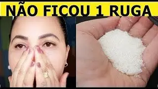 RUGAS NA TESTA E BOCHECHA CA&Iacute;DA NUNCA MAIS! Basta s&oacute; ISTO!
