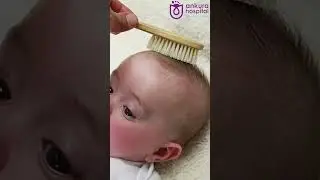 Ways to Treat and Prevent Cradle Cap in Babies || Dr. Krishna Chaitanya || Ankura Hospital LB Nagar