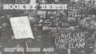 HOCKEY TEETH - NOT SO LONG AGO