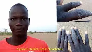 Message of safety/ Scorpion Control Center-Kakuma/ Kenya
