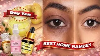 Remove Dark Circles Naturally at Home | Part 2 | Glow Up Series 💫