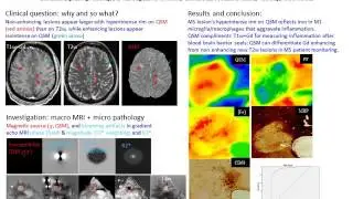 Yi Wang and David Pitt: QSM of MS Lesions