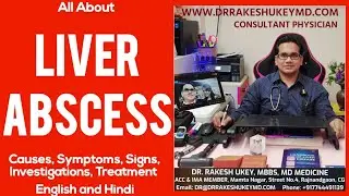 Liver Abscess (Pyogenic): Causes, Symptoms, Signs, Investigations, Treatment HINDI and ENGLISH
