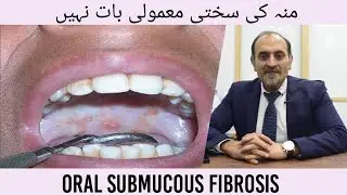 Oral Submucous Fibrosis (PRECAUTIONS)