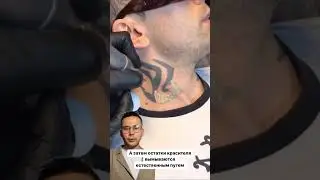 Удаление тату с помощью лазера