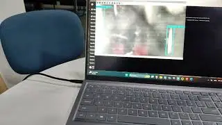 Surface defect detection using Raspberry pi 5 and Yolo v8