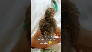 small bird rescue😢😍😍#shorts #shortvideo