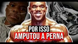A DESCOBERTA do real motivo por que Flex perdeu a perna