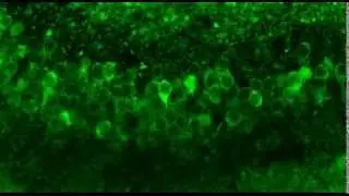 Monitoring neuronal activity in brain slices from a 2 year old Thy1-GCaMP3 transgenic mouse