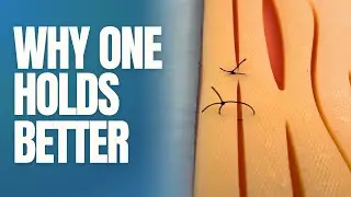 Surgeon&rsquo;s Knot vs Square Knot - Why One Holds Better