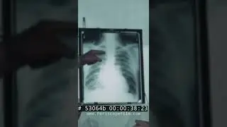 X-ray test routine in the 1940s
