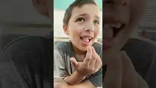 Attempt 2 of pulling off my tooth ￼
