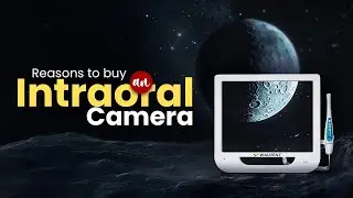 Reasons to Buy an Intraoral Camera | Waldent Smart-Cam with HD, WiFi & 12MP Sensor