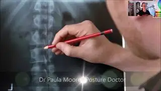 X-Ray Report - When You Need a Better Diagnosis