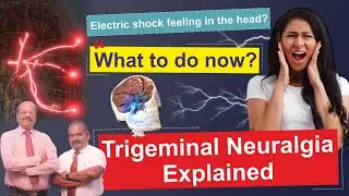 Electric Shock feeling in the head? | What to do now? Trigeminal Neuralgia explained