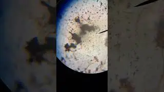 Silver staining of Treponema pallidum #medico_aanchal_03 #shorts #biology #neet #mbbs #reel #microbe