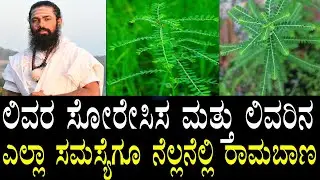 ಬಂಗಾರದ ಬೆಲೆ..! ಈ ಗಿಡ ಎಲ್ಲಿ ಸಿಕ್ಕರೂ ಬಿಡಬೇಡಿ | Nelanelli Gida Uses in Kannada