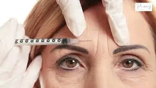 From Frown Lines to Fabulous &ndash; Wrinkle Relaxers in #prospertx 💖