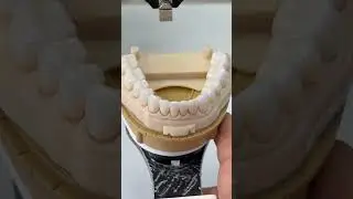 Lower full mouth all ceramics