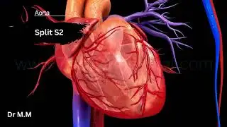 Split S2: The Sound of a Healthy Heart! ❤️ (Normal vs. Abnormal)