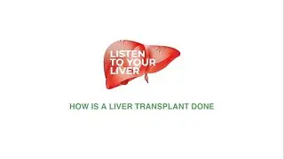 How Is A Liver Transplant Done? Dr. Vivek Vij | AILBS India