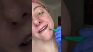 LIVE: Ultimate Non-Invasive Glow &mdash; Dermaplane, Cold Plasma, FSM Sculpting & Microneedling