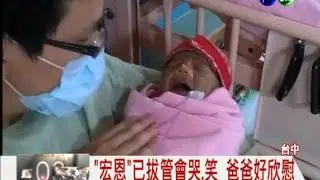 生命奇蹟! 男嬰已拔管會哭喊