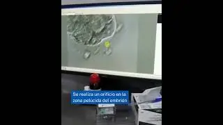 Hatching asistido Fertility Madrid