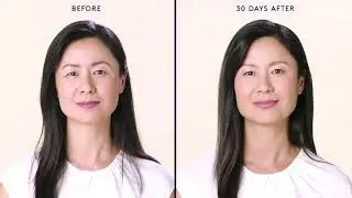 Botox Near Me - Botox Richmond Hill