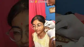 Ear piercing / ear pin | no pain ear Piercing #earpin #earpiercing #shortvideo #shortsviral