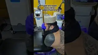 saidur tatto remove center/contact number:01920812698 #youtubeshorts #foryou #fypviralシ #subscribe