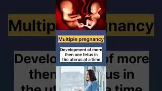 obstretics terminology (obg) #gynecology #nursing #education #youtubeshorts #nursingtips