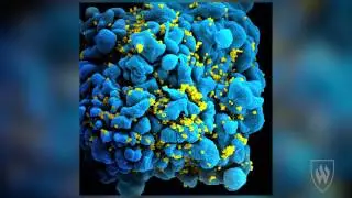 Unit 6 Featured Disease: HIV/AIDS