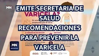 EMITE SECRETARIA DE SALUD RECOMENDACIONES PARA PREVENIR LA VARICELA