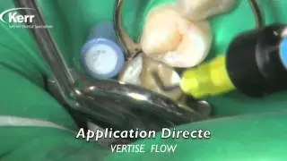 Vertise Flow