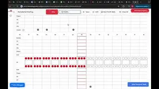 Better Diagnostics voice perio charting