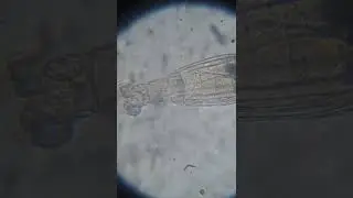 Rotifer Mastax - Shy fella (400x) #microscope