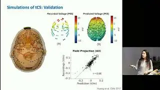 CIBC: Sumientra Rampersad, Is temporal interference the key to noninvasive deep brain stimulation?
