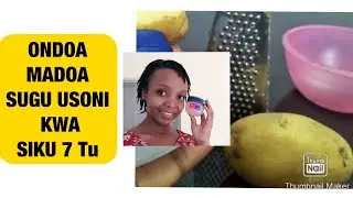 RAINISHA USO NA VASELINE NA VIAZI KWA SIKU 7// TUMIA MBINU HII KUONDOA MADOA SUGU USONI