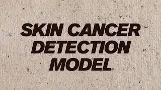 AI Capstone Project | Skin Cancer Detection Model