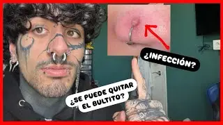COMO QUITAR el BULTITO 🤢  del PIERCING: ¿ES INFECCIÓN? ¿GRANULOMA?