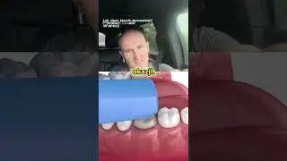 KORONA CZY LIC&Oacute;WKA 😳🤔 (🦷)