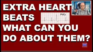Extra Heartbeats What you need to know and can do Dr. Nik Nikam