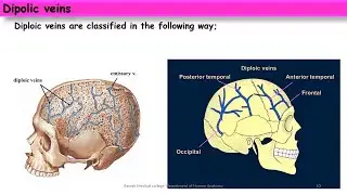 Discuss the diploic veins; Anatomy and clinical anatomy