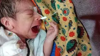 So sweet and loud cry newborn baby boy just after birth 🥰😘❤️💞#youtube #medical #trend#cute#doctor