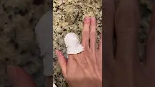 You MUST DO THIS if you cut off your finger - Save your finger while you can!!